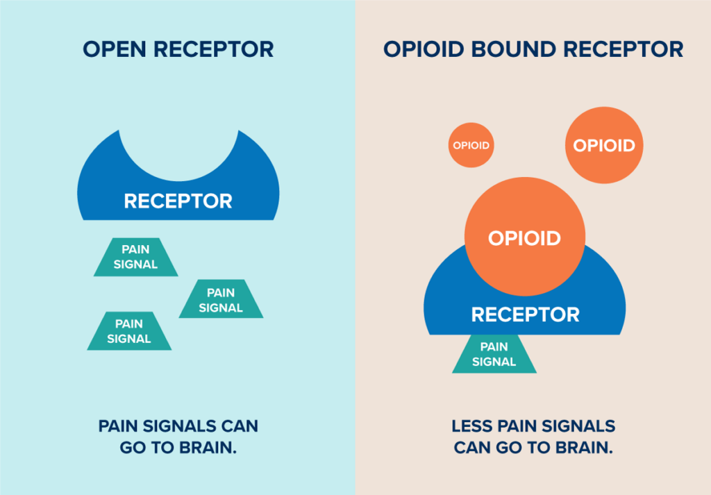 A graphic that shows the difference between an open receptor that allows pain signals to go to the brain and an opioid bound receptor that allows less pain signals to go to the brain.